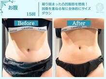 フローフシ∞/お腹の脂肪をスッキリと