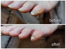 【ネイルケア】小指