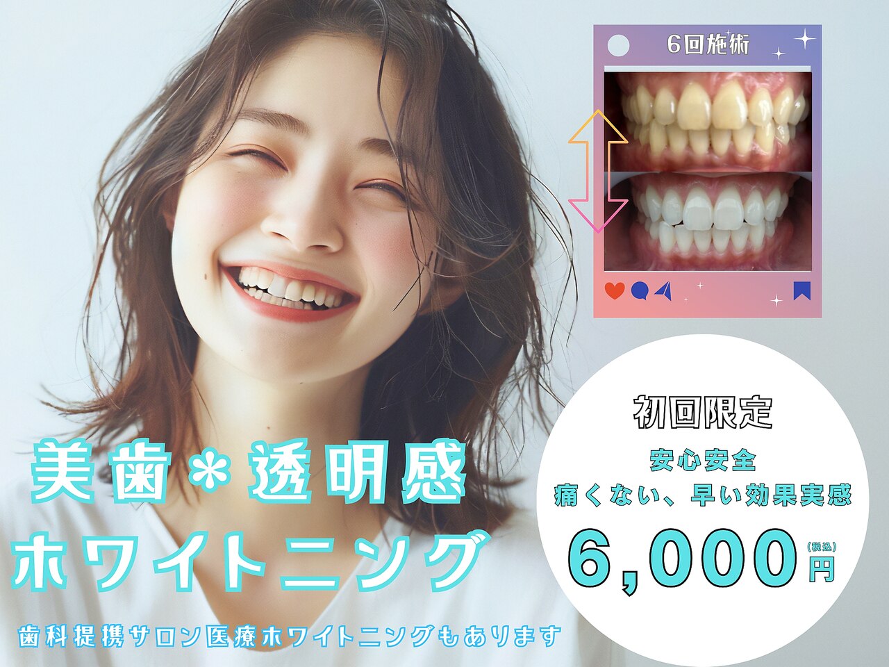 【美容ホワイトニング】美歯＊透明感ホワイトニング\7,800→\6,000｜男女対応