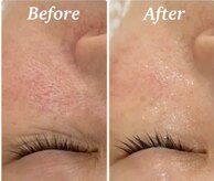 ラボーテ(La Beaute)