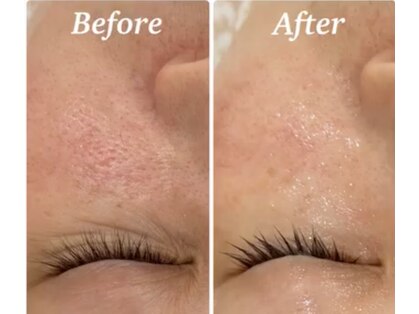 ラボーテ(La Beaute)の写真