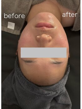 ココ アンジュ(COCO ANGE)/