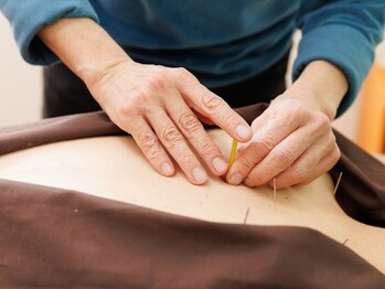 はな鍼灸院の写真/心身のバランスを整える鍼と灸で、あなたの身体を心底からケア。深い眠りと癒し、気力向上を☆