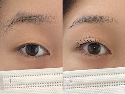 ウイル(uiru)の写真