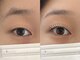 ウイル(uiru)の写真