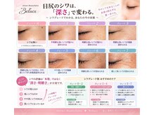 ベルーチェ(Beluce)/目のシワグレード別アプローチ
