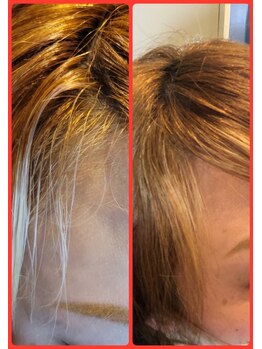 シャルム(charme)/ケアエク