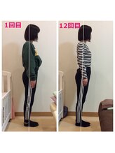 こおりやま整体院/反り腰は骨盤矯正から！