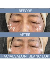 ブランロップ(BLANC LOP)/【タラソ】エイジング予防にも◎