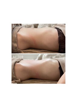 サンジュウロクドゴブ(36.5℃)/腸もみ