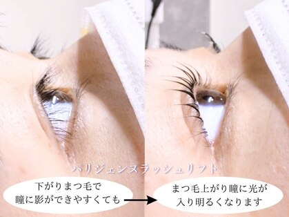 アイハビー 葛西駅前(eyeHbe)の写真