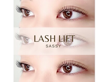 サッシー(SASSY)の写真