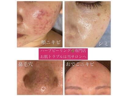 ビューティサロン アール(R)の写真