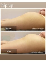 ミホノ 和泉中央店(mihono)/ヒップケア