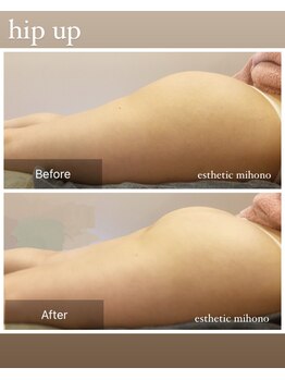 ミホノ 和泉中央店(mihono)/ヒップケア