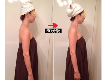 美座ノ女 梅田 淀屋橋本店/施術前後(右側)