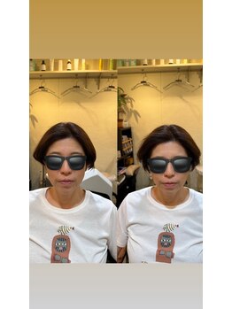 パボーネ(Pavone)/フェイスライン整う！