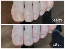 爪切り屋 足楽/【ネイルケア】