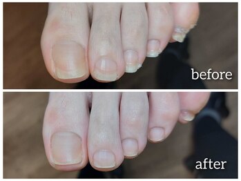 【ネイルケア】