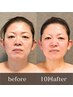 ★人気No.2【歪み・エラ張り・二重顎】骨格から整える｜バランスコルギ 130分