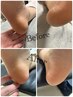 Foot【2回目以降の方】　つるつる角質ケア(単品)￥4500