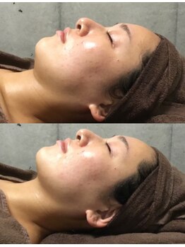 アネル 浦添店(anel)/