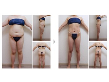 Nビューティー/最新エンダモロジーBODY