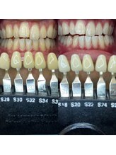 トウキョースワーズ 渋谷店(TOKYO SWRS)/#ホワイトニング #渋谷 #池袋