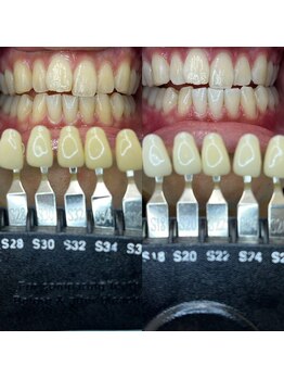 トウキョースワーズ 渋谷店(TOKYO SWRS)/#ホワイトニング #渋谷 #池袋