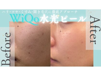 アイリス(AiRiS)の写真