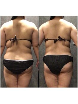 フローボディ 新山口店(flow BODY)/山口のエステはflow BODY