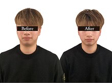 整体と美容鍼 無名/Before＆After【心斎橋/南船場】