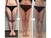 美人バスト 新宿店/☆姉妹店ダイエット症例写真☆