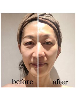 銀座レイア/【VARビフォーアフター】