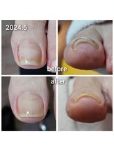 爪切り屋 足楽/ＵＰジェル★