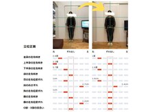 篠丸接骨院/ ◎施術実績◎前傾姿勢の改善