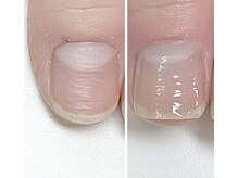 ルクレール カシェット(Le clair cachette)/美爪育成3ヶ月コース