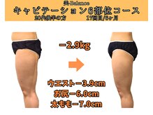 ビーバランス 本町店(美-Balance)/20代後半　月6部位コース