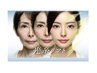 【4週間以内来店◇6回目まで】最新ケア＆痛みナシ"光糸リフト"【たるみ改善】