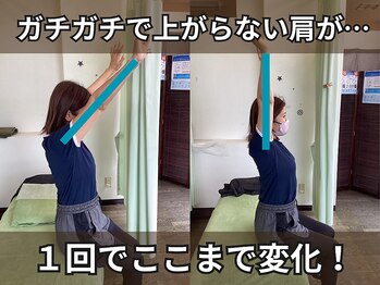 やまうら整骨院/肩こり・巻き肩・二重アゴに