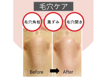 ユフラ(Yufla)の写真
