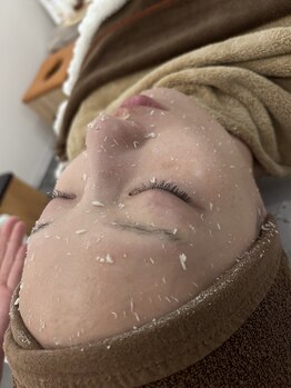 温オン(ON)の写真/韓国肌管理と丁寧な角質整理で目指す、あこがれの女優肌へ！輝くツヤ肌で魅力を引き立てるケアを◎