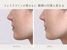 りんぱサロン まりの雰囲気(1回でも実感。キュッとしきしまった理想のフェイスラインへ)