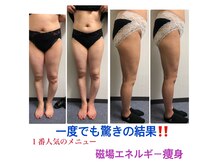 ビオナス(BIONAZ)の雰囲気（３０分で同時に二カ所を鍛えられるのは、北九州唯一！凄いです！）
