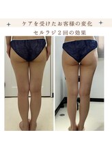 サロン叶(kanau)/頑固なセル脂肪撃退