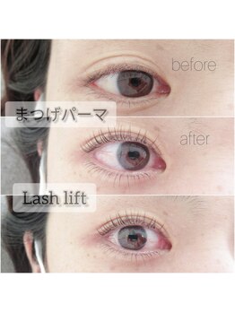 アイシック 勝どき(eyechic)/上下まつげパーマ(マツパ)勝どき