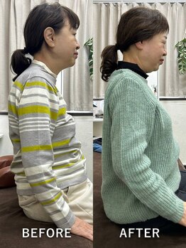 上六ミューク整体院/ご近所さんから若返ったねと