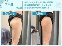 フローフシ∞/【痩身】下半身・お尻の脂肪撃退