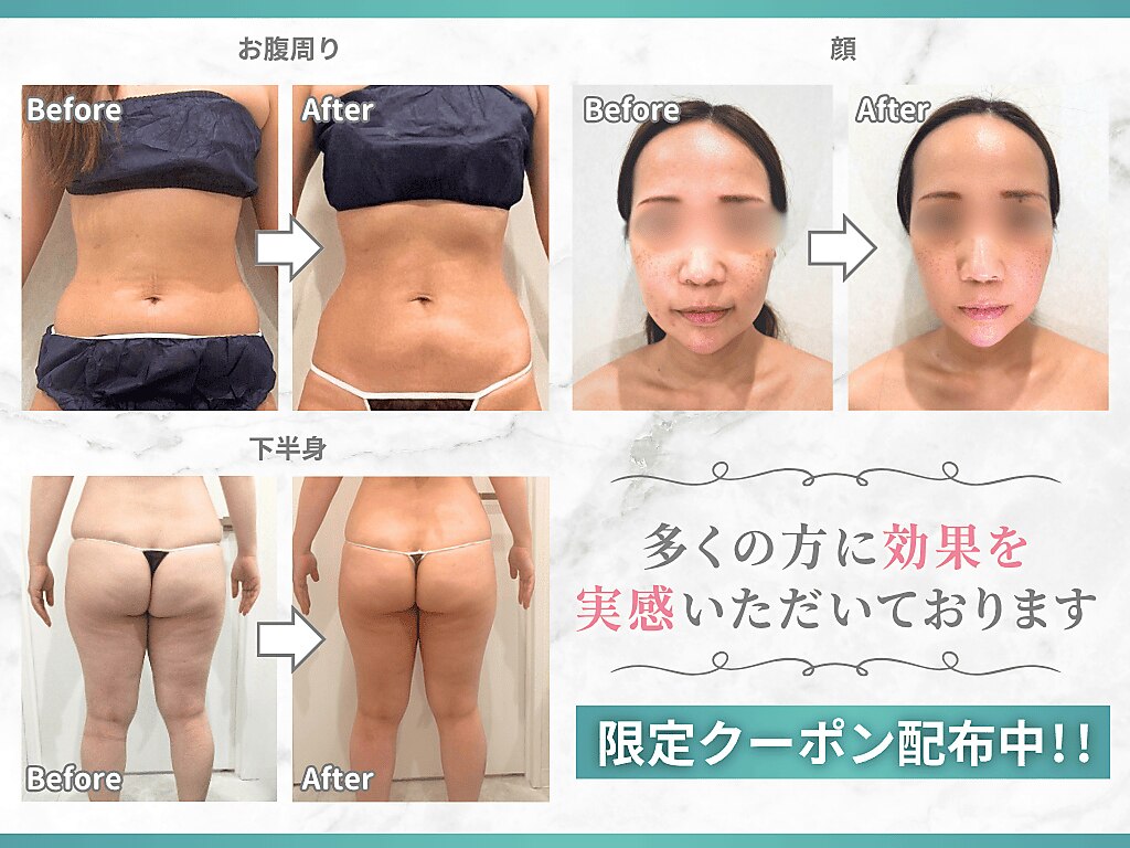 荒川区でエンダモロジーが人気のエステサロン｜ホットペッパービューティー