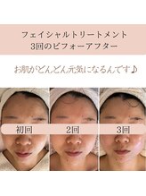 ココロ(COCORO)/お肌とカラダを整えるセルラム